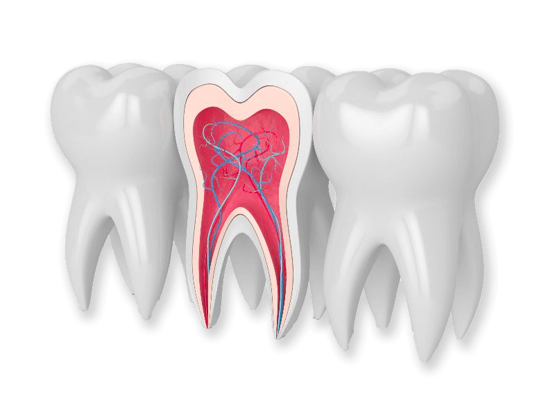 عصب کشی دندان