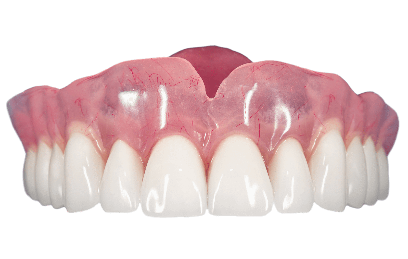 پروتزهای دندانی