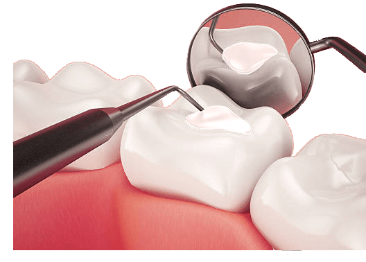 ترمیم دندان