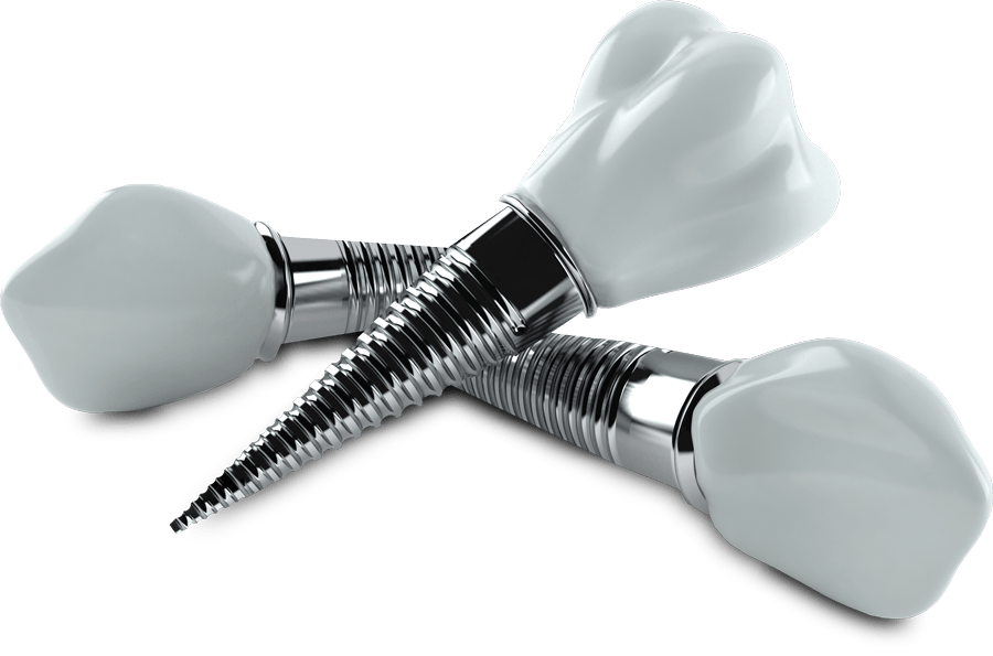 ایمپلنت دندان