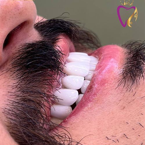 Untitled-1غتفغتفغ