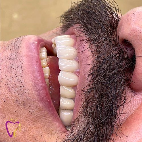 Untitled-1قغیستفغفغ