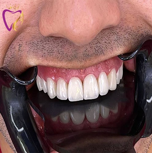 Untitled-2dfghdfg-min