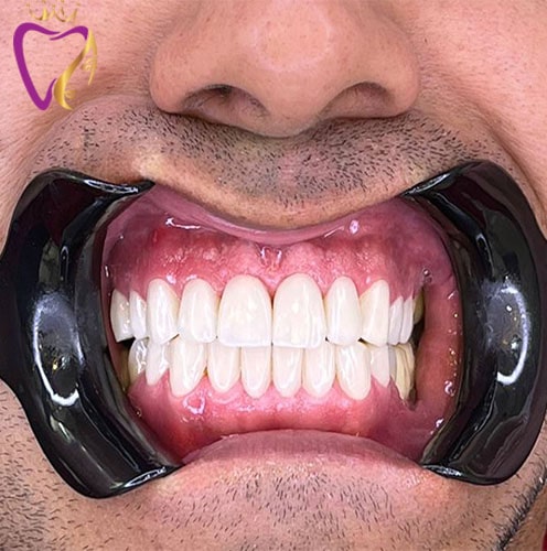 Untitled-2sdfsfsdf-min