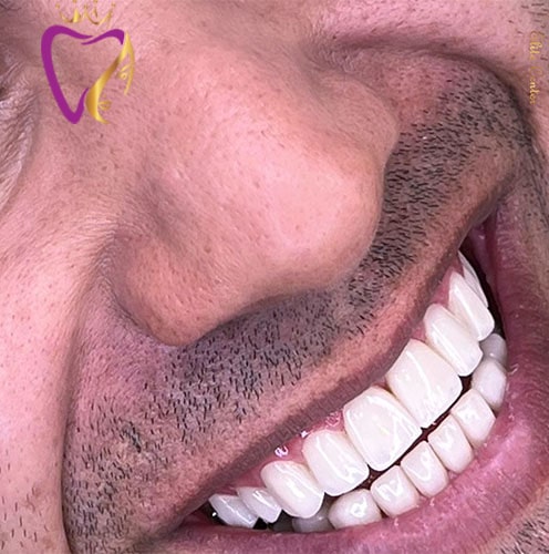 Untitled-2sefsefse-min