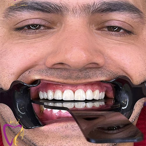 Untitled-2سیsdبلی-min