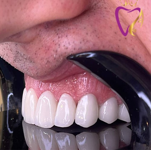 Untitled-3fsdgdfg-min