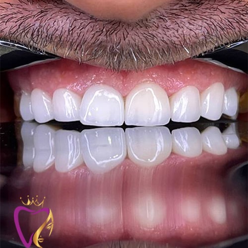 Untitled-3قثلثقفقثف-min