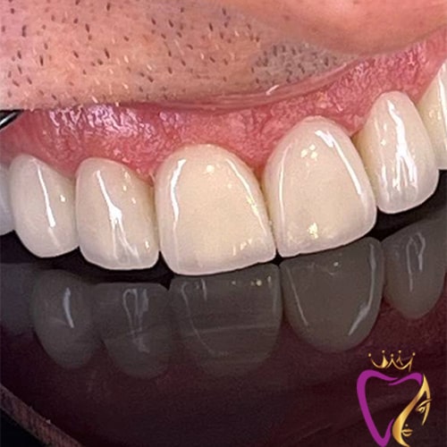 Untitled-4dgdgdf-min