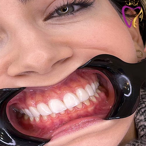 Untitled-4ikyuky-min