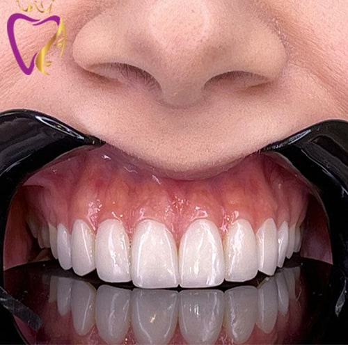 Untitled-5iukluik-min