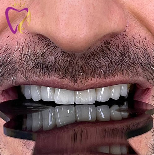 Untitled-7iktuik,-min