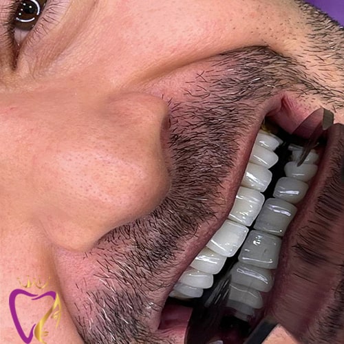 Untitled-7iuoyuyi-min