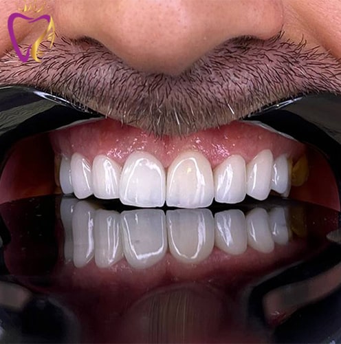 Untitled-7tikuik-min