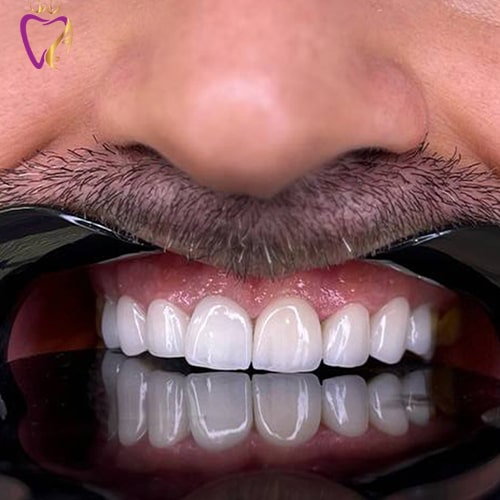 Untitled-8نهوملتو-min