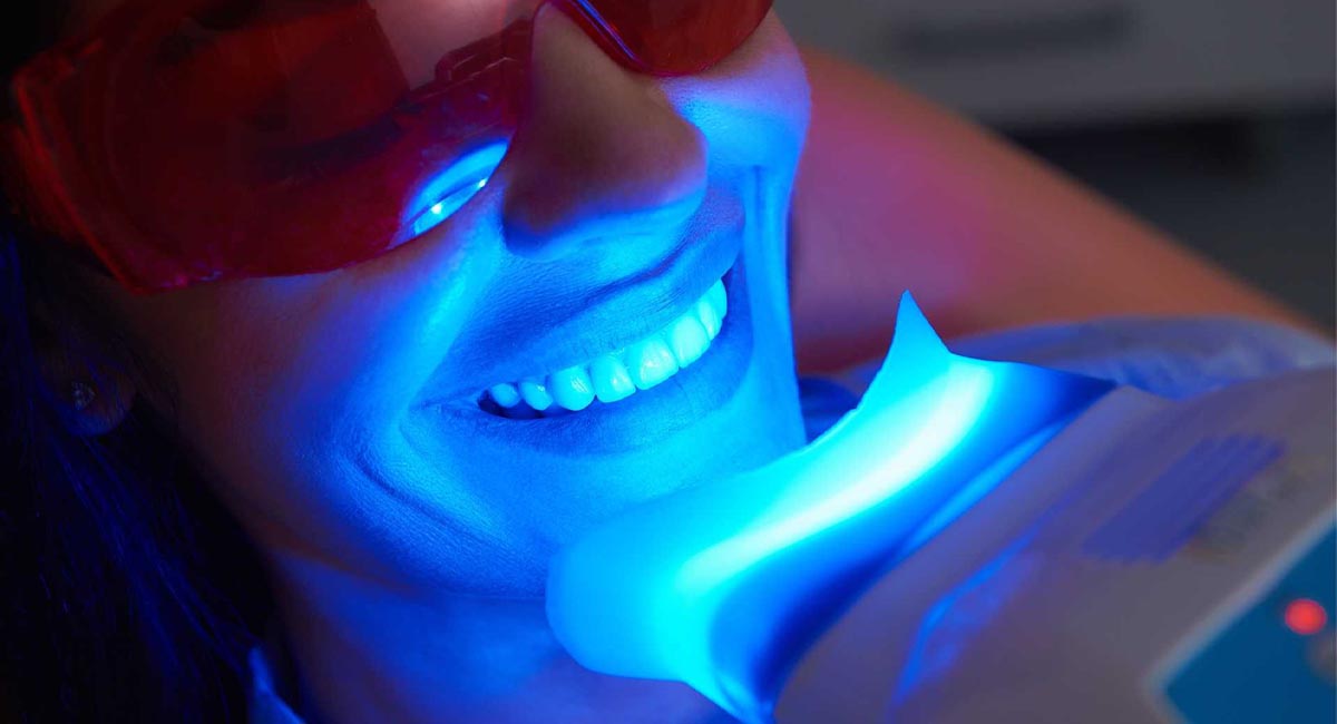 مرکز بلیچینگ دندان در هروی