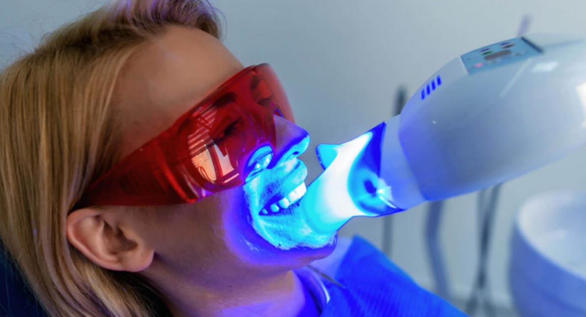 مرکز بلیچینگ دندان در هروی