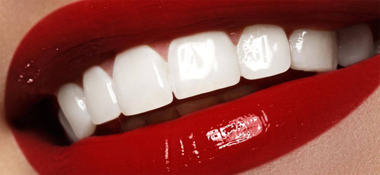 بهترین کامپوزیت دندان شمال تهران