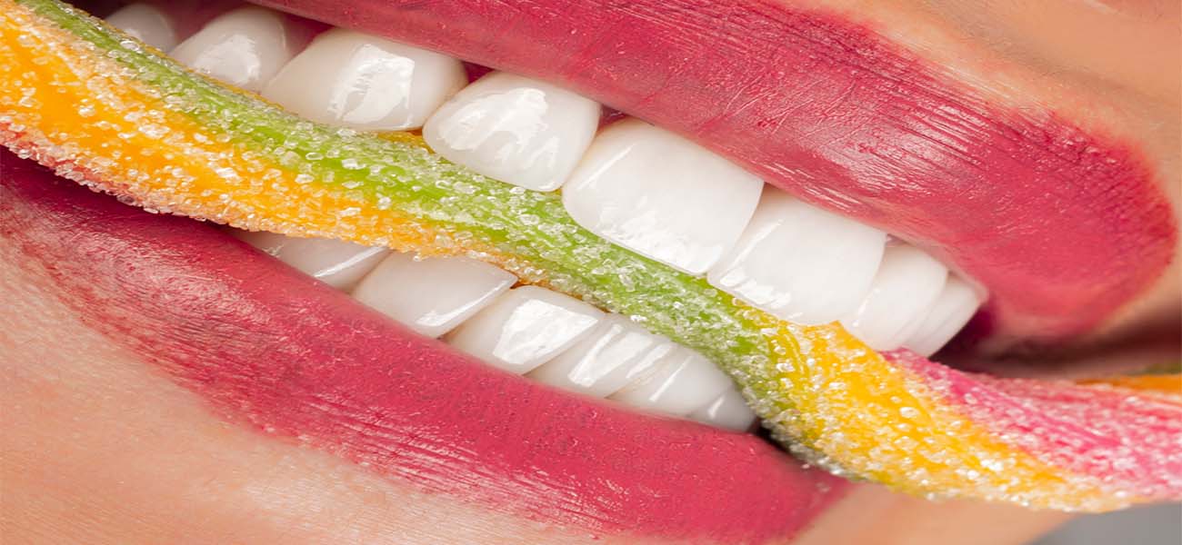 لمینت بدون تراش دندان شمال تهران